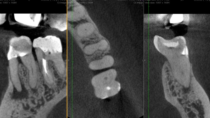 Planejamento CBCT