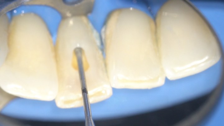 Reanatomização